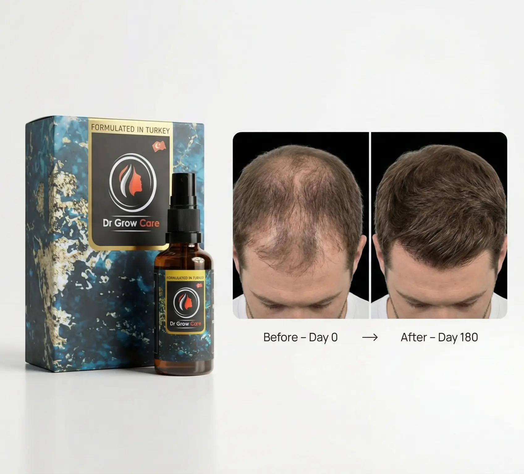 Dr Grow Care hair growth oil with before and after comparison showing reduced hair thinning and improved hair density after 180 days.